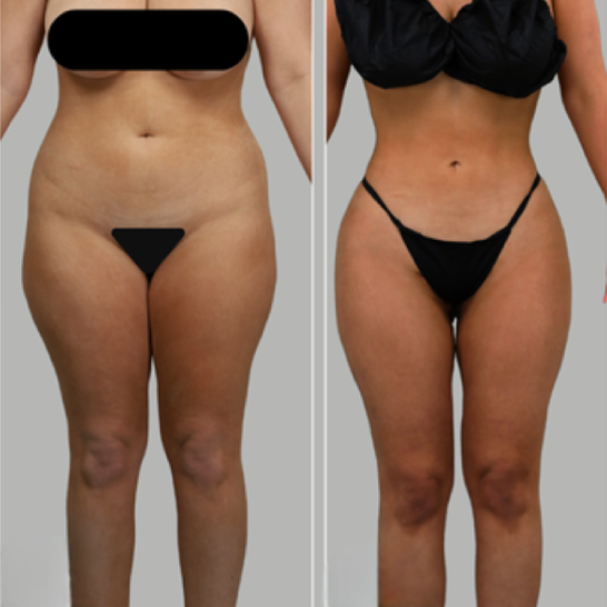 B&A