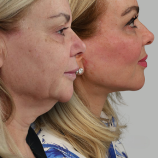 B&A