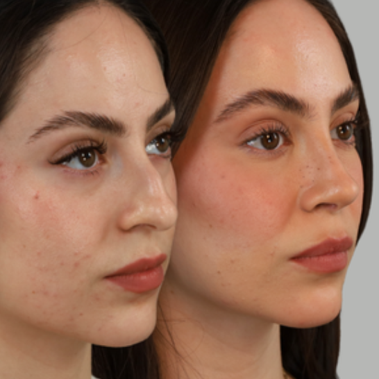 B&A